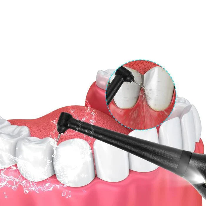 DÉTARTREUR DENTAIRE ÉLECTRIQUE